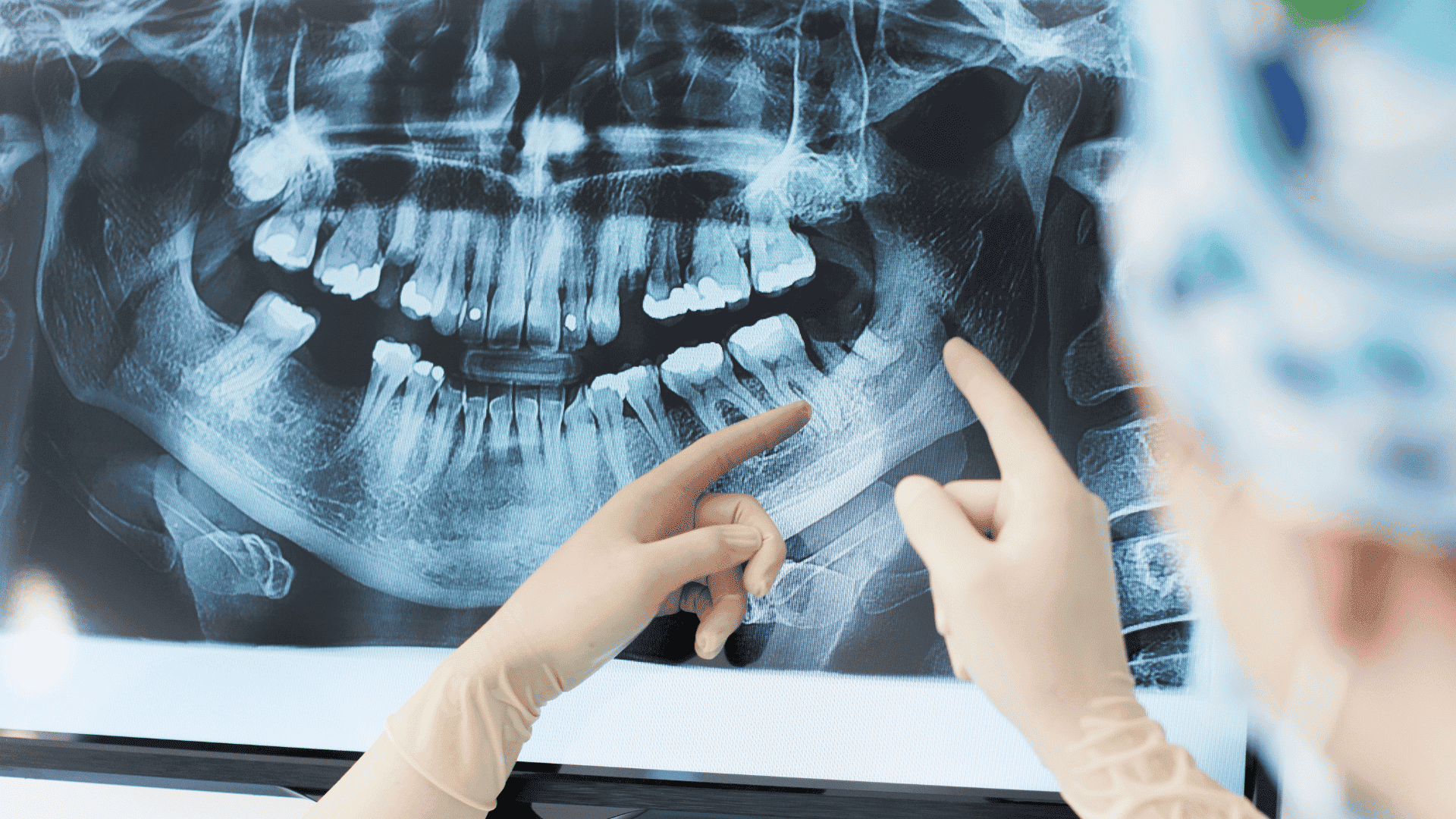 Esami RX digitali e tridimensionali Priolo Gargallo