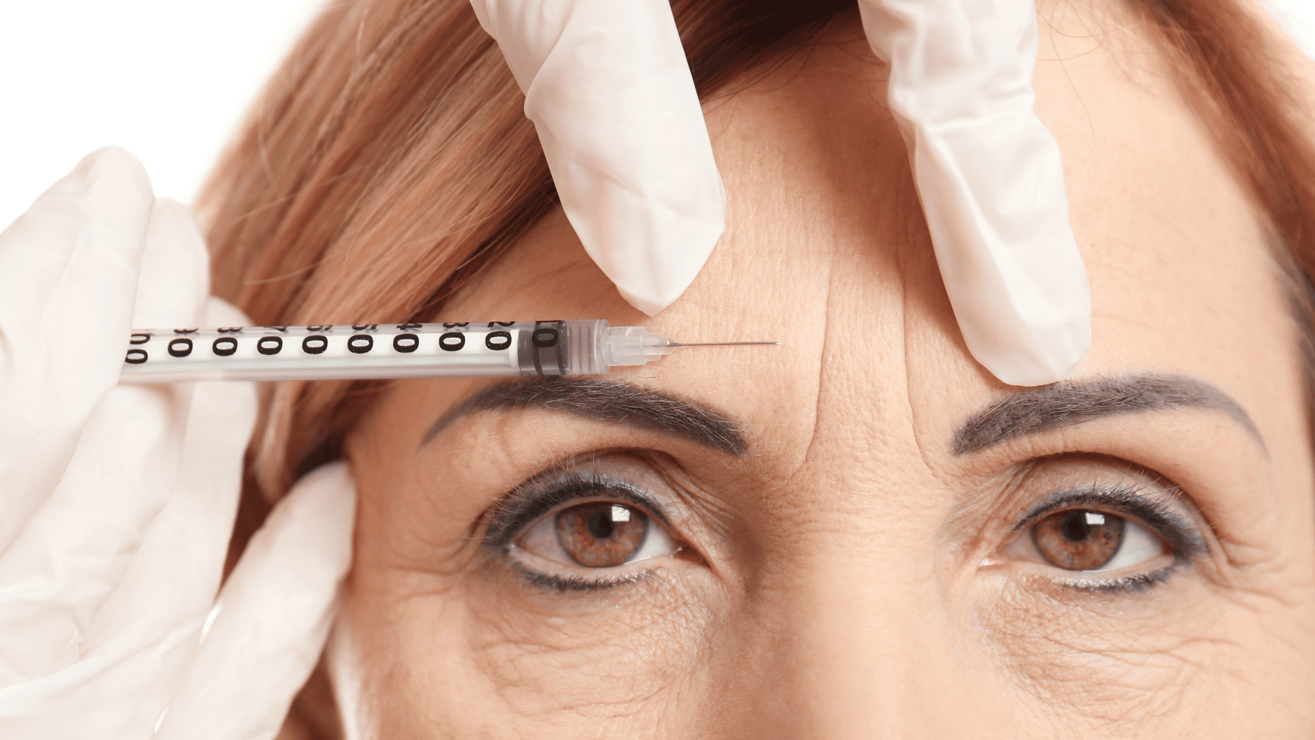 botox priolo gargallo
