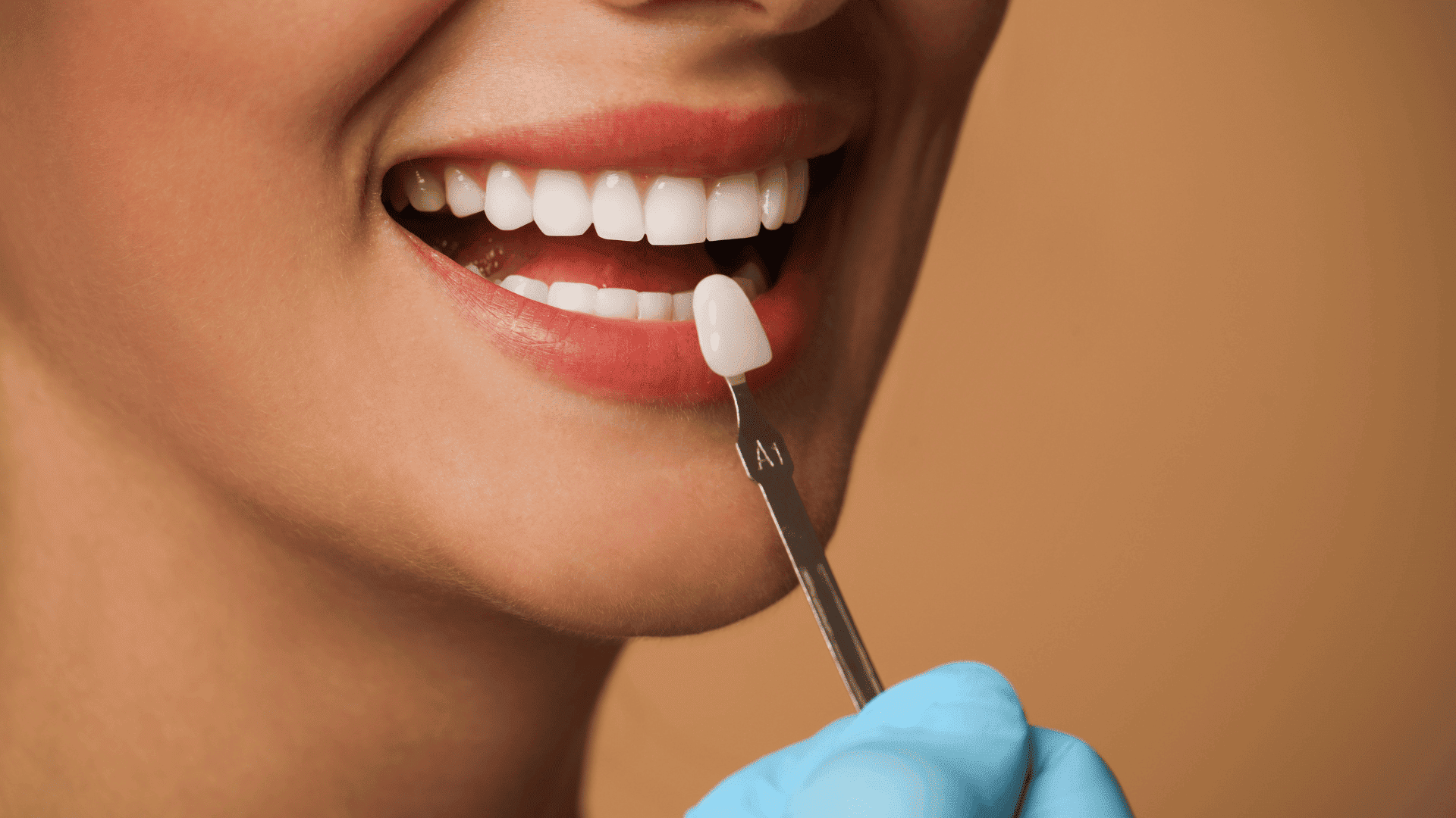 faccette dentali priolo faccette dentali priolo