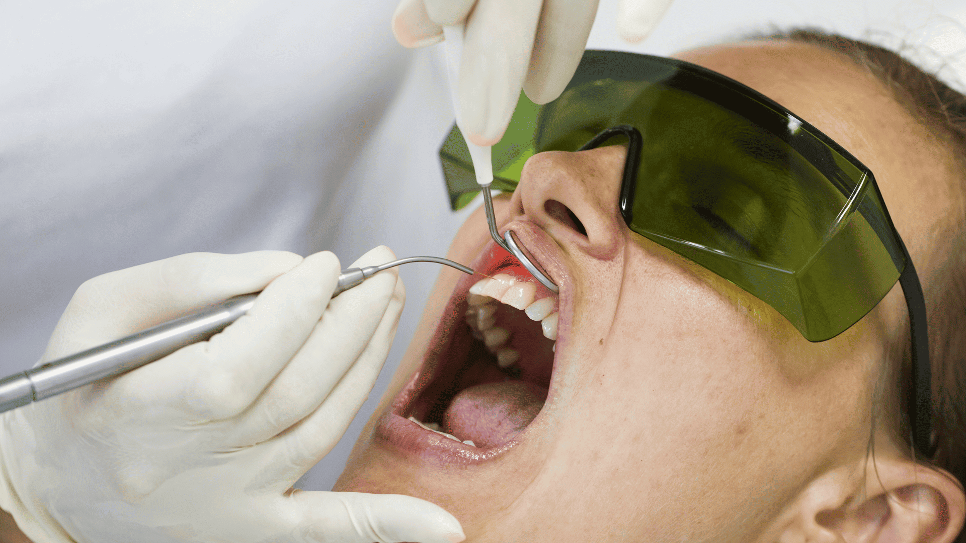 laser terapia priolo gargallo laser terapia priolo gargallo